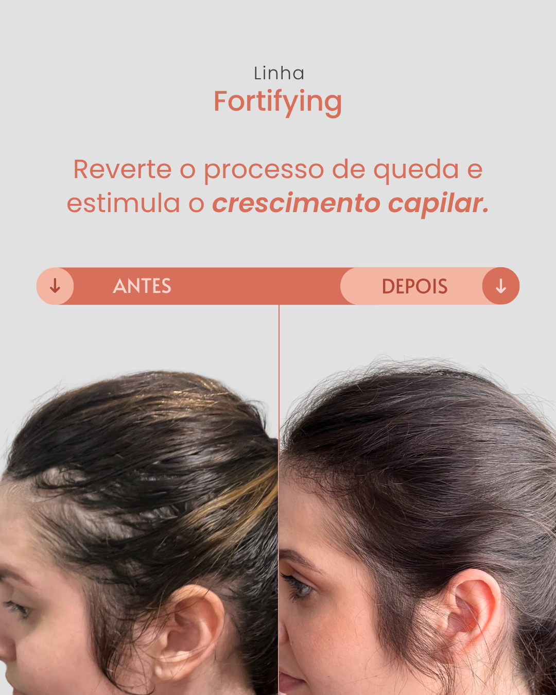 Tônico Antiqueda Fortifying 60ml