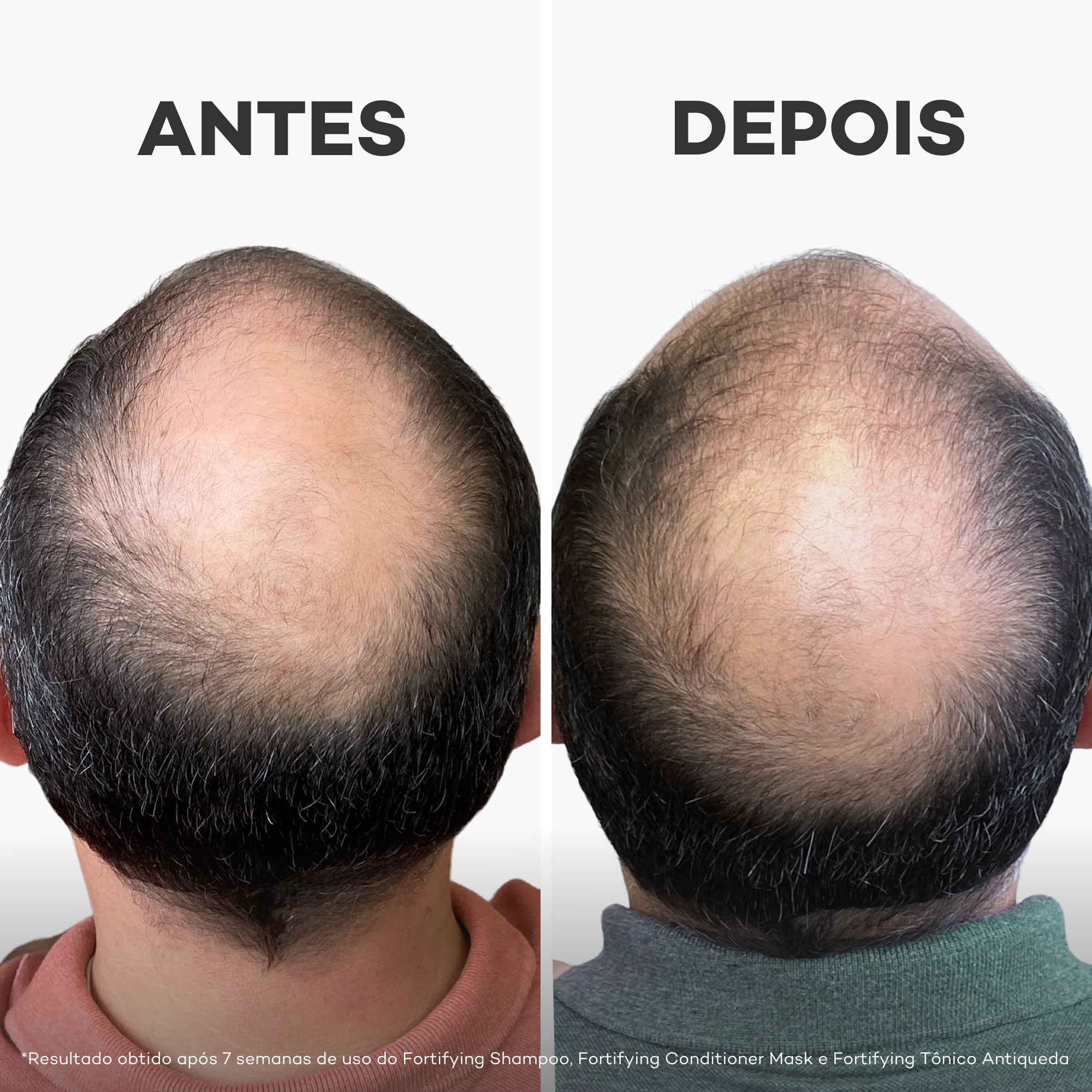 Tônico Antiqueda Fortifying 60ml